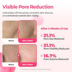 Dr.Melaxin Cemenrete Cyano Pink Spicule Serum with Calcium, korean skin care pore tightening refines pores tightening serum 1.01 fl. oz.