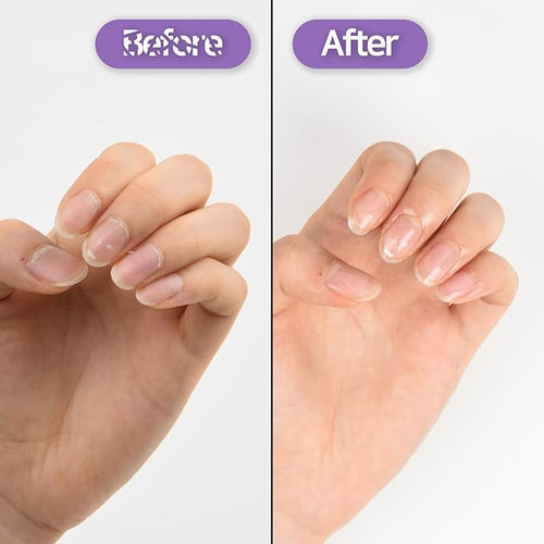 Baren Nail & Cuticle Oil Repair Essence Pen | Easy Pen Type | Strengthener for Damaged Nails | Korean Celebrity Nail Care Secret | Nail Growth Treatment with JoJoba Oil, Almond Oil, Vitamin E