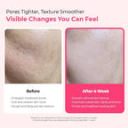 Dr.Melaxin Cemenrete Cyano Pink Spicule Serum with Calcium, korean skin care pore tightening refines pores tightening serum 1.01 fl. oz.
