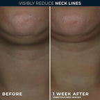 RoC Derm Correxion Neck Cream with Hyaluronic Acid + Advanced Retinol to visibly Tighten & Lift Horizontal Neck Lines, Facial Moisturizer to Contour Face (1.7 oz) with RoC Retinol Eye Packette