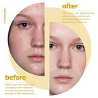 artnaturals Lactic Acid plus AHA Face Serum for Brightening Boost with Renewing Formula - Scars, Acne, Wrinkles - Exfoliates and Moisturizes the Skin - 1 oz.