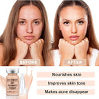 TRESSON BB Facial Glow Serum Starter Kit Hyaluronic Acid Essence Foundation Skin Care Kit 0.27oz 12 Vials, Combined With Niacinamide and Peptides To Skin Tone Anti-Aging Foundation Light Rose #3
