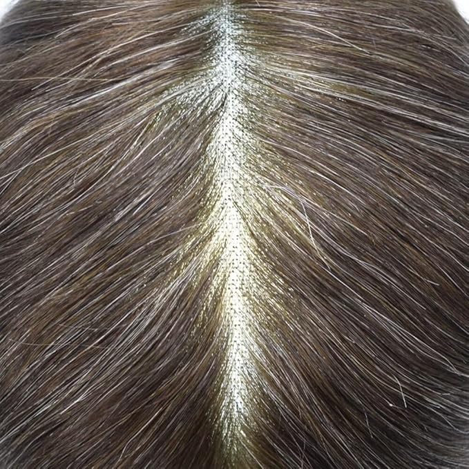 Toupee for Men French Lace Center Human Hair Replacement Systems Lace Center Hair Piece Mens Toupee Hair Units for Man V-Looped Male Hair Prosthesis 7"X9" #330 Dark Brown with 30% Gray