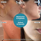 TruSkin Hyaluronic Acid Serum for Face + 7 Ultra Hydrating Ingredients – Best Face Serum for Moisturizing, Visibly Plumping Skin & Smoothing the Look of Fine Lines, 1 fl oz