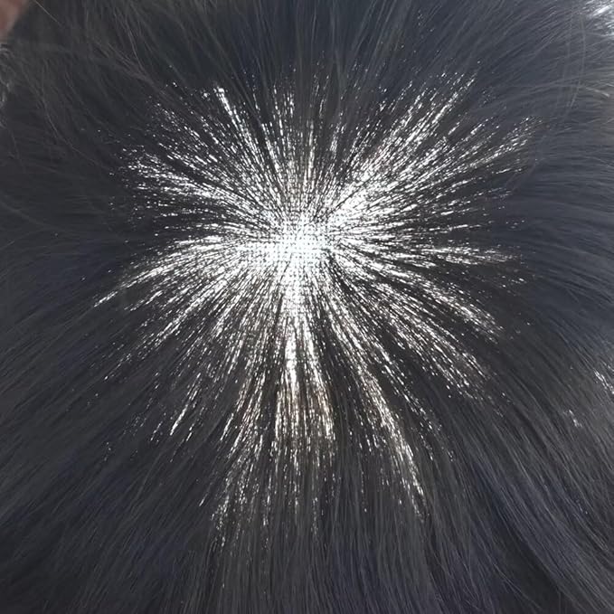 FACE MIRACLE Toupee for Men French Lace Hairpiece Human Hair Replacement System Skin PU Mens Toupee Hair Wigs for Man V-Looped Front Hair Prosthesis 6"X9" #2 Darkest Brown