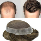 FACE MIRACLE Mens Toupee Lace Front Hairpieces Soft Human Hair Replacement System Natural Hairline Toupee for Men French Lace Poly V-Looped Mens hair Units 8"X10" 5#MEDIUM LIGHT BROWN