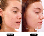 DermRays Revive Skincare for Anti-Aging, Glow Like Never Before,Multifunctional Beauty Device, Facial Massager for Home Use