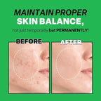 Troubless Mild Clear Toner Essence - Tea Tree Facial Toner for All Skin Types | Hydrating Skin Toner, Daily Skin Care (6.76 fl oz)