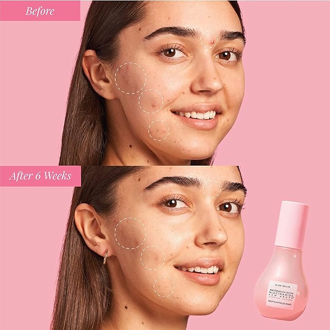 Glow Recipe Watermelon Niacinamide Dew Drops - Brightening, Plumping Hydrating Face Serum, Makeup Primer + Liquid Highlighter with Hyaluronic Acid - Dewy & Glowing Korean Skin Care (40ml)