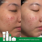 THANKYOU FARMER Phyto Relieful CICA PHA LHA Boosting Toner 7.03 fl oz (200ml), Dermatologist Tested, Alcohol-Free Liquid Exfoliant for Face, Oil-Free Hydrating Toner, Vegan, Fragrance-Free