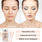 BB Pigment Serum Starter Kit Hyaluronic Acid Essence Foundation BB Facial Glow Skin Care Kit 0.27oz 12 Vials, Combined With Niacinamide and Peptides To Skin Tone Anti-Aging Foundation #1