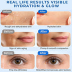 3% Hyaluronic Acid Serum, 4D Hyaluronic Acid Serum Ultra-Hydrating Vials, Hylunaric Acid Non-Greasy, Fast Absorption, Intensive Moisturizing, Deep Hydration & Smoothing (1 Box of 30 tubes)