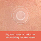 Rael Pimple Patches, Miracle Microcrystal Vitamin C Dark Spot Cover - Hydrocolloid Patch with Glutathione and Niacinamide, Korean Skin Care (9 Count)