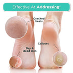 DERMORA Foot Peel Mask - 2 Pack of Regular Size Skin Exfoliating Foot Masks for Dry, Cracked Feet, Callus, Dead Skin Remover for Baby Soft Feet, Lavender Scent