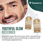 Hyaluronic Acid Wrinkle Serum, Vitamin C Serum for Face with Hyaluronic Acid, Retinol Serum for Face for Skin Elasticity, Fine Lines, and Dark Spots, Wrinkle Serum, 60-Day Supply TreeActiv