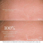 m-61 PowerGlow Peel | Exfoliating Facial Peel With Glycolic, Salicylic Acid. 1 Minute, 1 Step - 10 Treatments